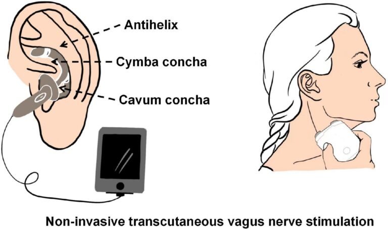 Vagus Nerve Ear Stimulation: A Simple Guide to How It Works and Why People Use It