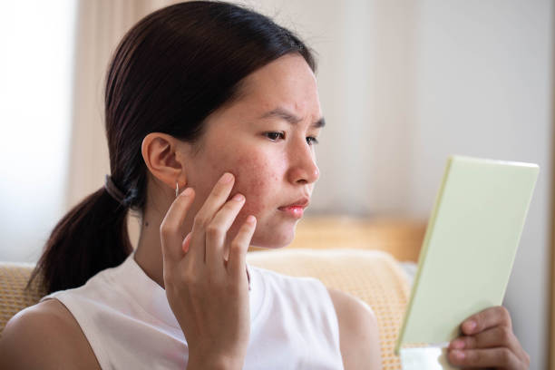How Hard Water Affects Skin, Hair, and Everyday Wellness