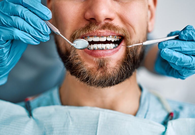 THE CONNECTION BETWEEN DENTAL ALIGNMENT AND OVERALL HEALTH: BEYOND THE SMILE THE CONNECTION BETWEEN DENTAL ALIGNMENT AND OVERALL HEALTH: BEYOND THE SMILE